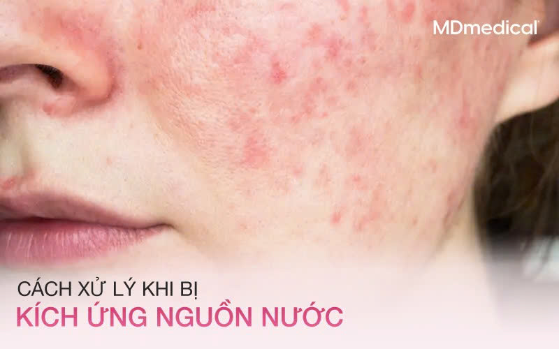 bí kíp chăm sóc da khi đi du lịch