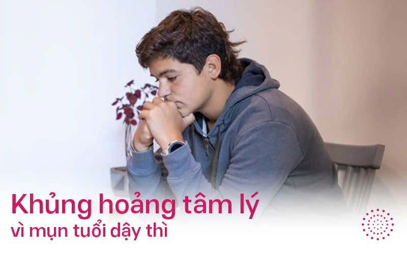 Khủng hoảng tâm lý vì mụn tuổi dậy thì: Cha mẹ cần làm gì để giúp con vượt qua tự ti?
