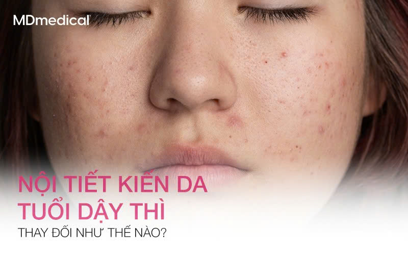 Da tuổi dậy thì thay đổi như thế nào dưới tác động của nội tiết tố?