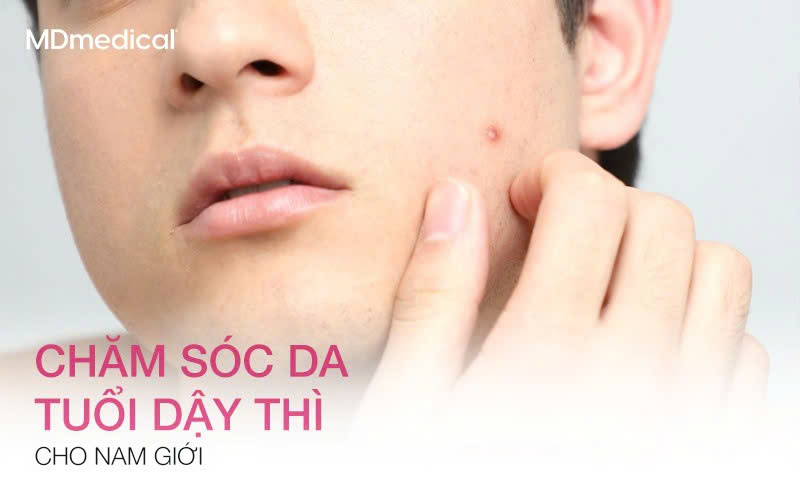 Khác biệt khi chăm sóc da tuổi dậy thì cho nam giới