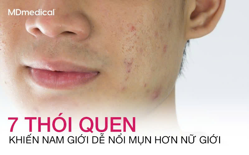7 thói quen khiến nam giới dễ nổi mụn hơn nữ giới