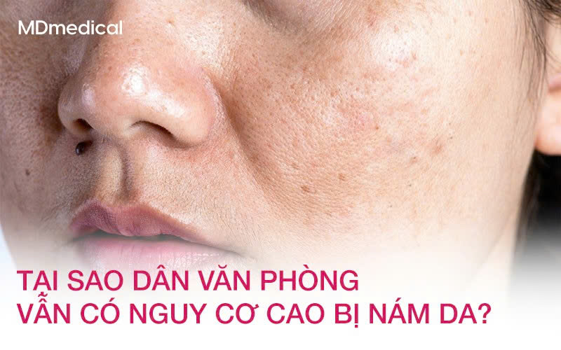 Tại sao dân văn phòng vẫn có nguy cơ cao bị nám da?
