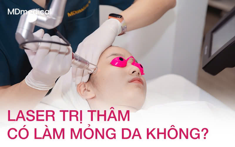 Laser trị thâm có làm mỏng da không?