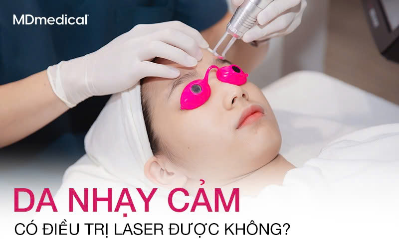 Da nhạy cảm có điều trị laser được không?