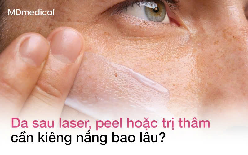 Da sau laser, peel hoặc điều trị thâm cần kiêng nắng bao lâu?