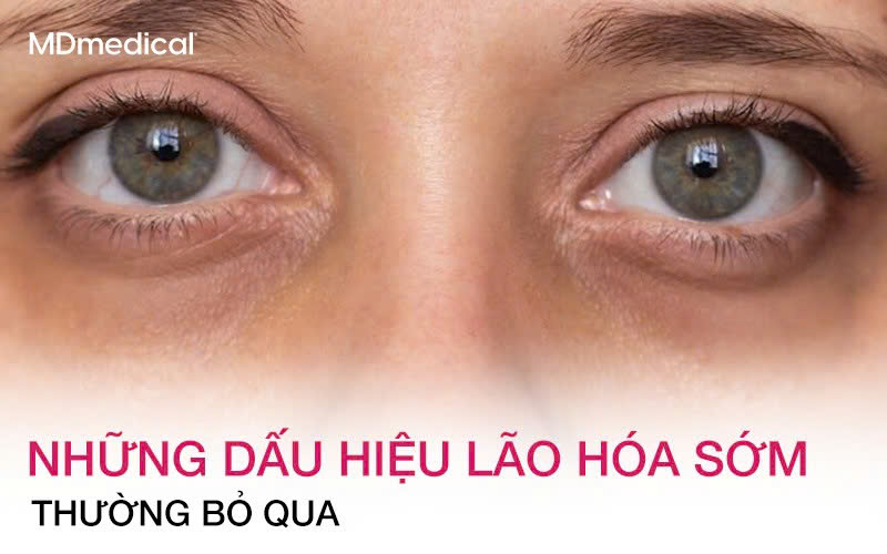 Những dấu hiệu lão hóa sớm nhiều người thường bỏ qua