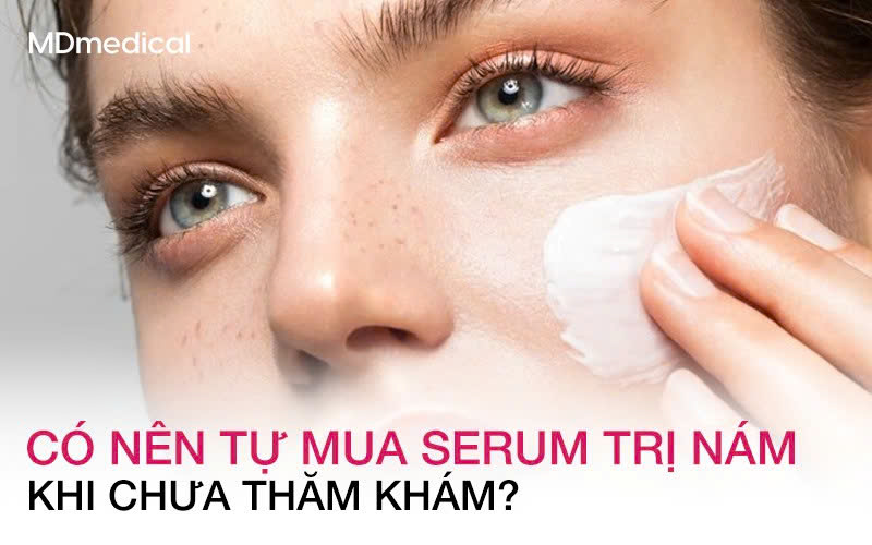 Có nên tự mua serum trị nám khi chưa thăm khám và đánh giá làn da?