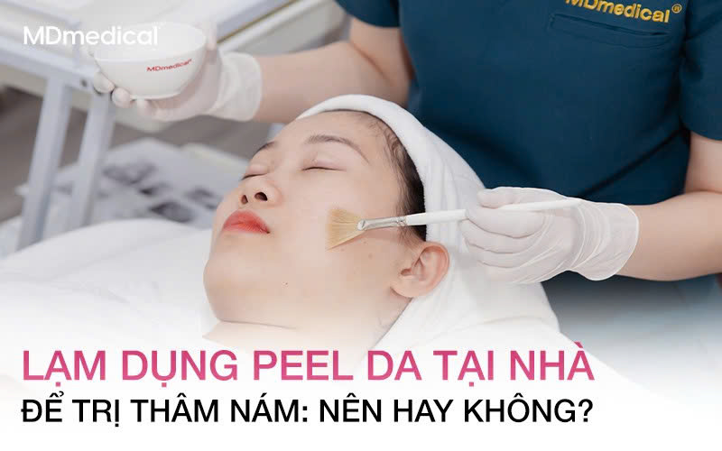 Lạm dụng Peel da tại nhà để trị thâm nám: Nên hay Không?