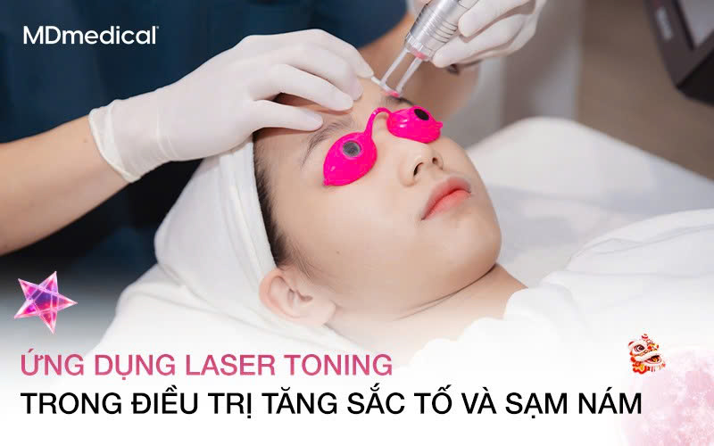 Ứng dụng Laser Toning trong điều trị tăng sắc tố và sạm nám