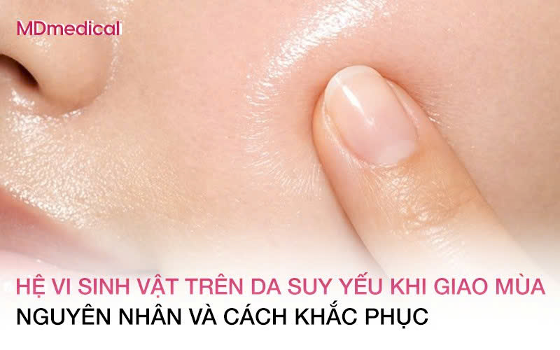 Hệ vi sinh vật trên da suy yếu khi giao mùa: Nguyên nhân gây mẩn đỏ và cách khắc phục