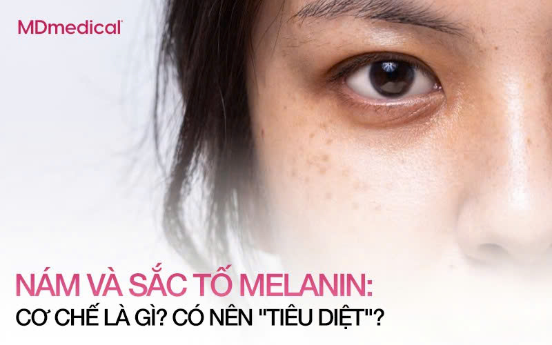 NÁM VÀ SẮC TỐ MELANIN: CƠ CHẾ LÀ GÌ? LIỆU CÓ NÊN “TIÊU DIỆT” MÀNG BẢO VỆ TỰ NHIÊN CỦA CƠ THỂ?